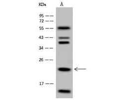 HINT3 Antibody, Novus Biologicals 50 &mu;g, Unconjugated:Antibodies, Polyclonal
