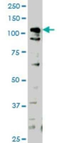 HIPK1 Antibody (1F2), Novus Biologicals 0.1 mg | Buy Online | Novus Biologicals | Fisher Scientific