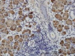 HIPK1 Antibody (4C2), Novus Biologicals 0.1 mg; Unconjugated:Antibodies,