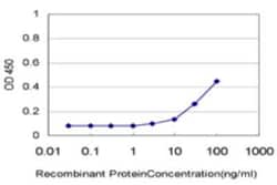 HIPK1 Antibody (4C2), Novus Biologicals 0.1 mg; Unconjugated:Antibodies,