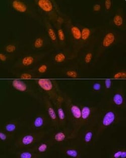 HIPK2 Rabbit anti-Human, Clone: 3Z5P6, Novus Biologicals:Antibodies:Primary