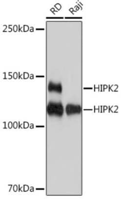 HIPK2 Rabbit anti-Human, Clone: 3Z5P6, Novus Biologicals:Antibodies:Primary