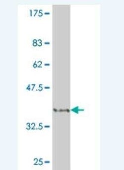 HIPK2 Antibody (1D8), Novus Biologicals 0.1 mg | Buy Online | Novus Biologicals | Fisher Scientific