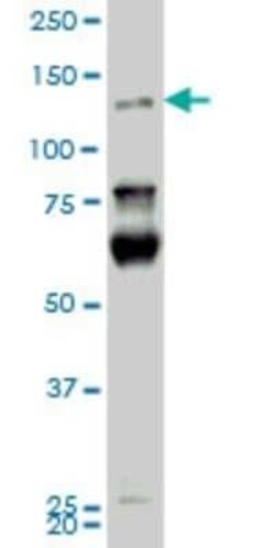 HIPK2 Antibody (4F4), Novus Biologicals 0.1 mg | Buy Online | Novus Biologicals | Fisher Scientific