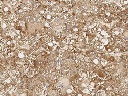 HIPK2 Antibody, Novus Biologicals 100 &mu;g, Unconjugated:Antibodies, Polyclonal