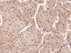 HIPK2 Antibody, Novus Biologicals 50 &mu;g; Unconjugated:Antibodies, Polyclonal