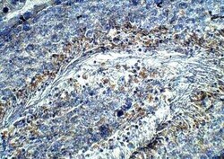 HIPK4 Antibody, Novus Biologicals 100 &mu;g | Buy Online | Novus Biologicals | Fisher Scientific