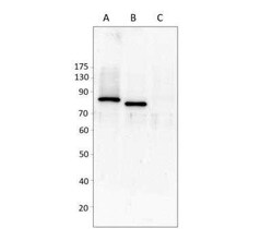 HIPK4 Antibody, Novus Biologicals 100 &mu;g | Buy Online | Novus Biologicals | Fisher Scientific