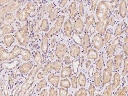 HISPPD1 Antibody, Novus Biologicals 50 &mu;g, Unconjugated:Antibodies,