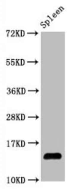 HIST1H2AB, Hydroxy Tyr39 Antibody (3B12), Novus Biologicals 100 &mu;g;