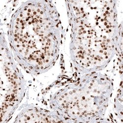 HIST1H2AG Antibody (CL5039), Novus Biologicals 100&mu;L:Antibodies, Monoclonal