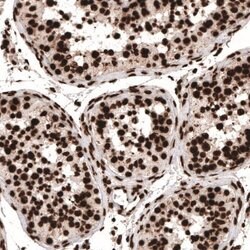 HIST1H3A Antibody (CL4967), Novus Biologicals:Antibodies:Primary Antibodies