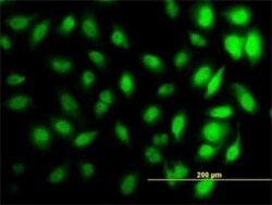 HIST1H3D Antibody (1D8), Novus Biologicals 0.1 mg | Buy Online | Novus Biologicals | Fisher Scientific