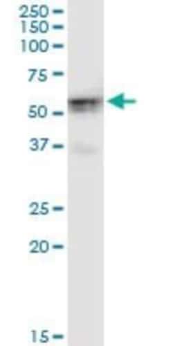 HKDC1 Antibody (3A2), Novus Biologicals 0.1 mg; Unconjugated:Antibodies,