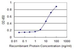 HKDC1 Antibody (3A2), Novus Biologicals 0.1 mg; Unconjugated:Antibodies,