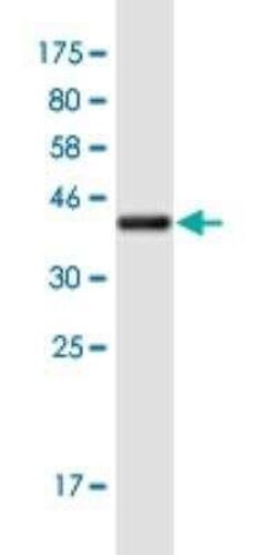 HKR1 Antibody (8E5), Novus Biologicals 100 &mu;g | Buy Online | Novus Biologicals | Fisher Scientific