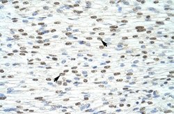 HKR1 Antibody, Novus Biologicals 100 &mu;L | Buy Online | Novus Biologicals | Fisher Scientific