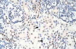 HKR1 Antibody, Novus Biologicals 100 &mu;L | Buy Online | Novus Biologicals | Fisher Scientific
