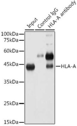 HLA A Rabbit anti-Human, Clone: 8L2H2, Novus Biologicals 20 &mu;g | Buy Online | Novus Biologicals | Fisher Scientific
