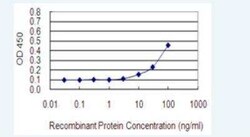 HLA A Antibody (2D6), Novus Biologicals 100 &mu;g | Buy Online | Novus Biologicals | Fisher Scientific