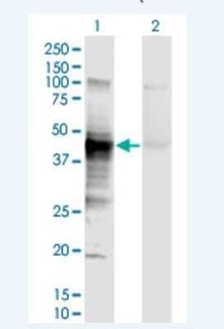 HLA A Antibody (2D6), Novus Biologicals 100 &mu;g | Buy Online | Novus Biologicals | Fisher Scientific