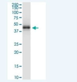 HLA A Antibody (2D6), Novus Biologicals 100 &mu;g | Buy Online | Novus Biologicals | Fisher Scientific