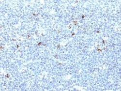 HLA A Antibody (CATA-1), Novus Biologicals:Antibodies:Primary Antibodies