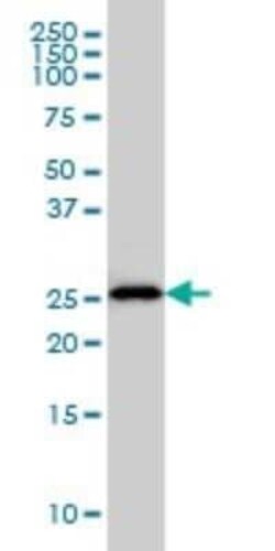 HLA DMA Antibody (3F12-F11), Novus Biologicals 0.1 mg | Buy Online | Novus Biologicals | Fisher Scientific