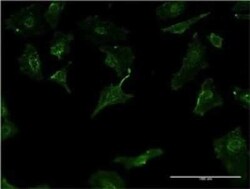 HLA DMB Antibody (2D3), Novus Biologicals 0.1 mg | Buy Online | Novus Biologicals | Fisher Scientific