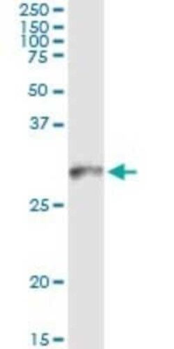 HLA DMB Antibody (4D12), Novus Biologicals 0.1 mg | Buy Online | Novus Biologicals | Fisher Scientific
