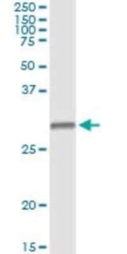 HLA DMB Antibody (7D11), Novus Biologicals 0.1 mg, Unconjugated:Anticuerpos