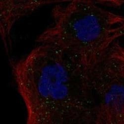HLA DMB Rabbit anti-Human, Polyclonal, Novus Biologicals 25 &mu;g; Unconjugated:Antibodies,