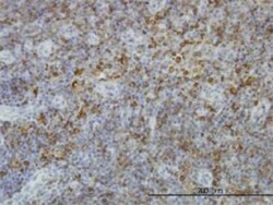 Novus Biologicals HLA DPB1 Antibody (6C6), Novus Biologicals 0.1 mg | Buy Online | Novus Biologicals&trade; | Fisher Scientific