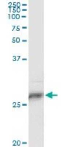 Novus Biologicals HLA DPB1 Antibody (6C6), Novus Biologicals 0.1 mg | Buy Online | Novus Biologicals&trade; | Fisher Scientific