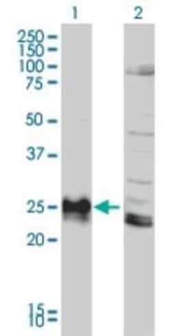 Novus Biologicals HLA DPB1 Antibody (6C6), Novus Biologicals 0.1 mg | Buy Online | Novus Biologicals&trade; | Fisher Scientific
