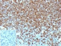 HLA DQ/DR/DP Mouse anti-Human, Clone: HLA-Pan/6663, Novus Biologicals 100