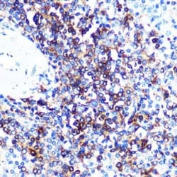 HLA DQA1 Rabbit anti-Human, Mouse, Rat, Clone: 7W0M7, Novus Biologicals:Antibodies:Primary