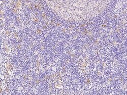 HLA DQA1 Antibody, Novus Biologicals 100 &mu;g | Buy Online | Novus Biologicals | Fisher Scientific