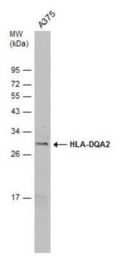 HLA DQA2 Antibody, Novus Biologicals 100 &mu;g | Buy Online | Novus Biologicals | Fisher Scientific