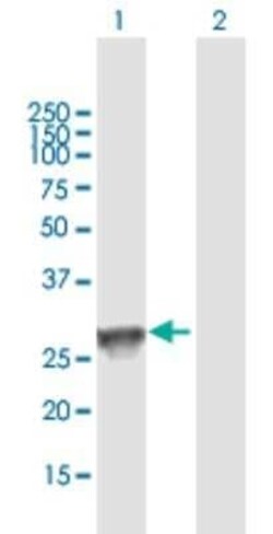 HLA DQB1 Antibody, Novus Biologicals 0.05 mg | Buy Online | Novus Biologicals | Fisher Scientific