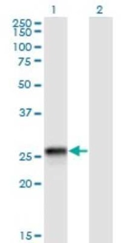 HLA DQB2 Antibody (4C3), Novus Biologicals 0.1 mg | Buy Online | Novus Biologicals | Fisher Scientific