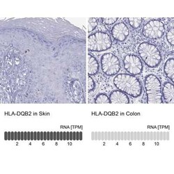 HLA DQB2 Rabbit anti-Human, Polyclonal, Novus Biologicals 25 &mu;g; Unconjugated:Antibodies,