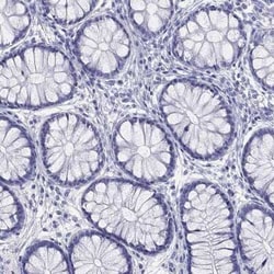 HLA DQB2 Rabbit anti-Human, Polyclonal, Novus Biologicals 25 &mu;g; Unconjugated:Antibodies,