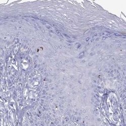 HLA DQB2 Rabbit anti-Human, Polyclonal, Novus Biologicals 25 &mu;g; Unconjugated:Antibodies,