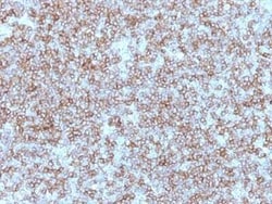 HLA DR/DP Antibody (Bra-14), Novus Biologicals:Antibodies:Primary Antibodies