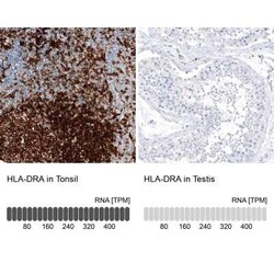 HLA DRA Antibody (CL10964), Novus Biologicals:Antibodies:Primary Antibodies