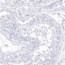 HLA DRA Antibody (CL10964), Novus Biologicals:Antibodies:Primary Antibodies