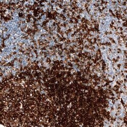 HLA DRA Antibody (CL10964), Novus Biologicals:Antibodies:Primary Antibodies