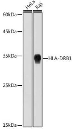 HLA DRB1 Rabbit anti-Human, Clone: 6Z1F10, Novus Biologicals 20 &mu;g | Buy Online | Novus Biologicals | Fisher Scientific
