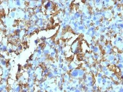 HLA DRB1 Antibody (LN-3 + HLA-DRB/1067), Novus Biologicals 0.02mg; Unlabeled:Antibodies,
